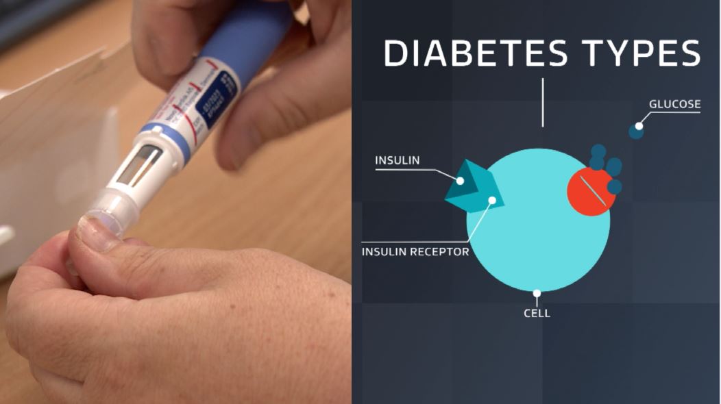 Diabetes injections can be used to prevent the condition