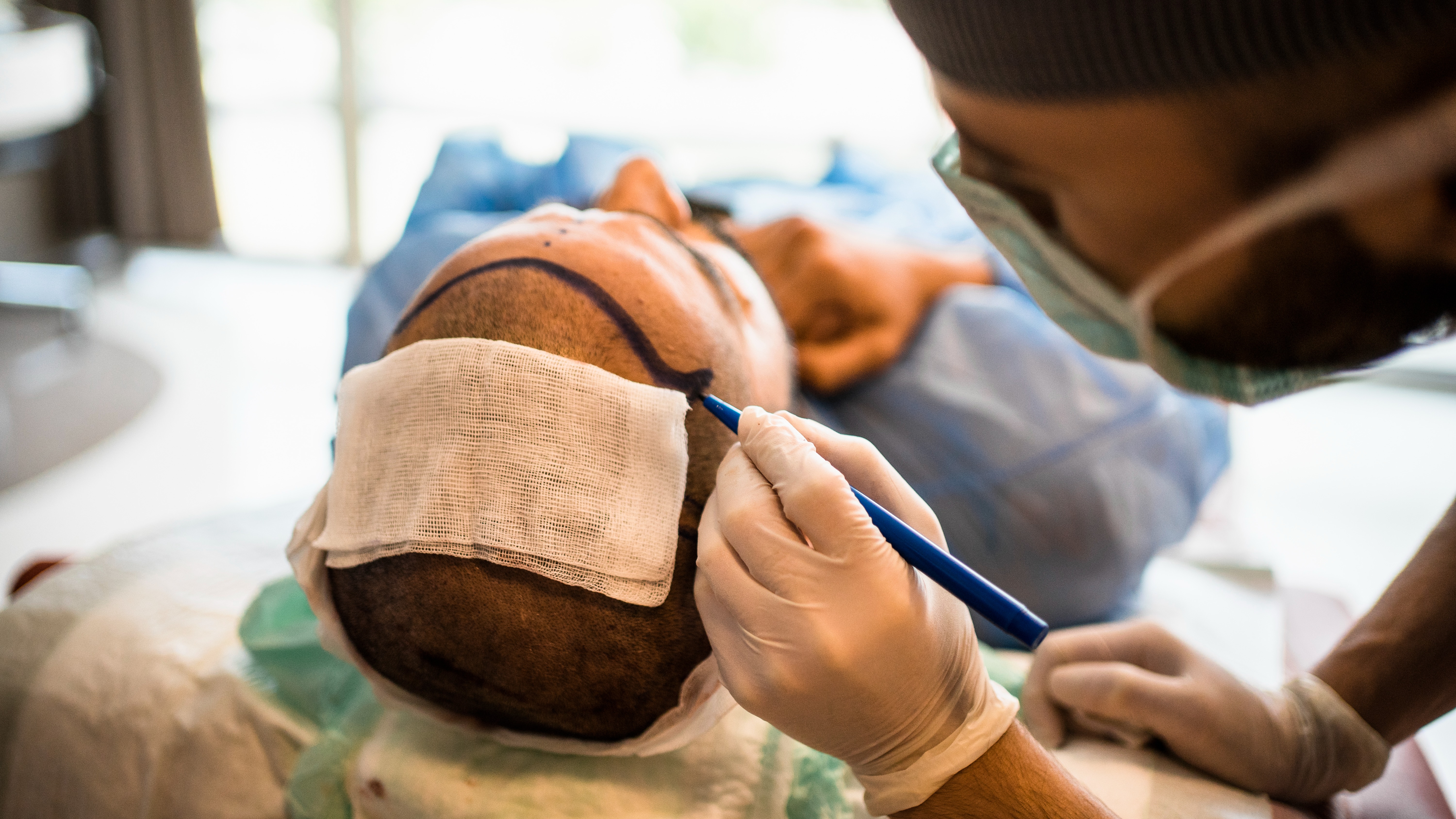 'It was horrific': UK hair transplant patients left disfigured and scarred