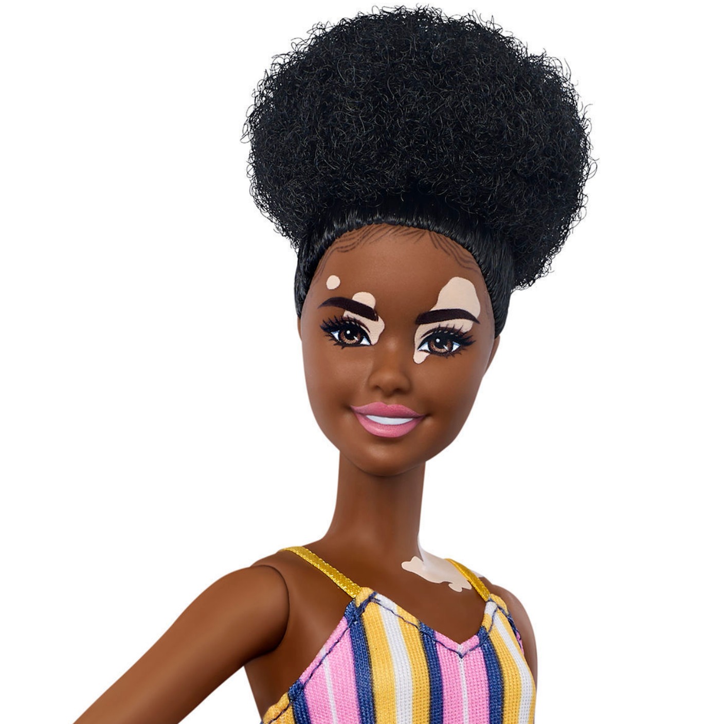 barbie with vitiligo