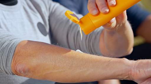 How UV rays cause sunburn - and why sun cream still matters in spring