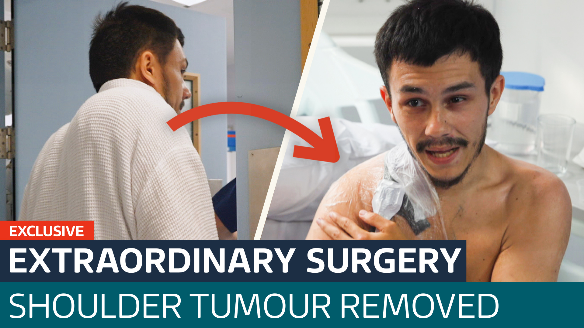 How surgeons removed a tumour the size of a bowling ball from this man's shoulder