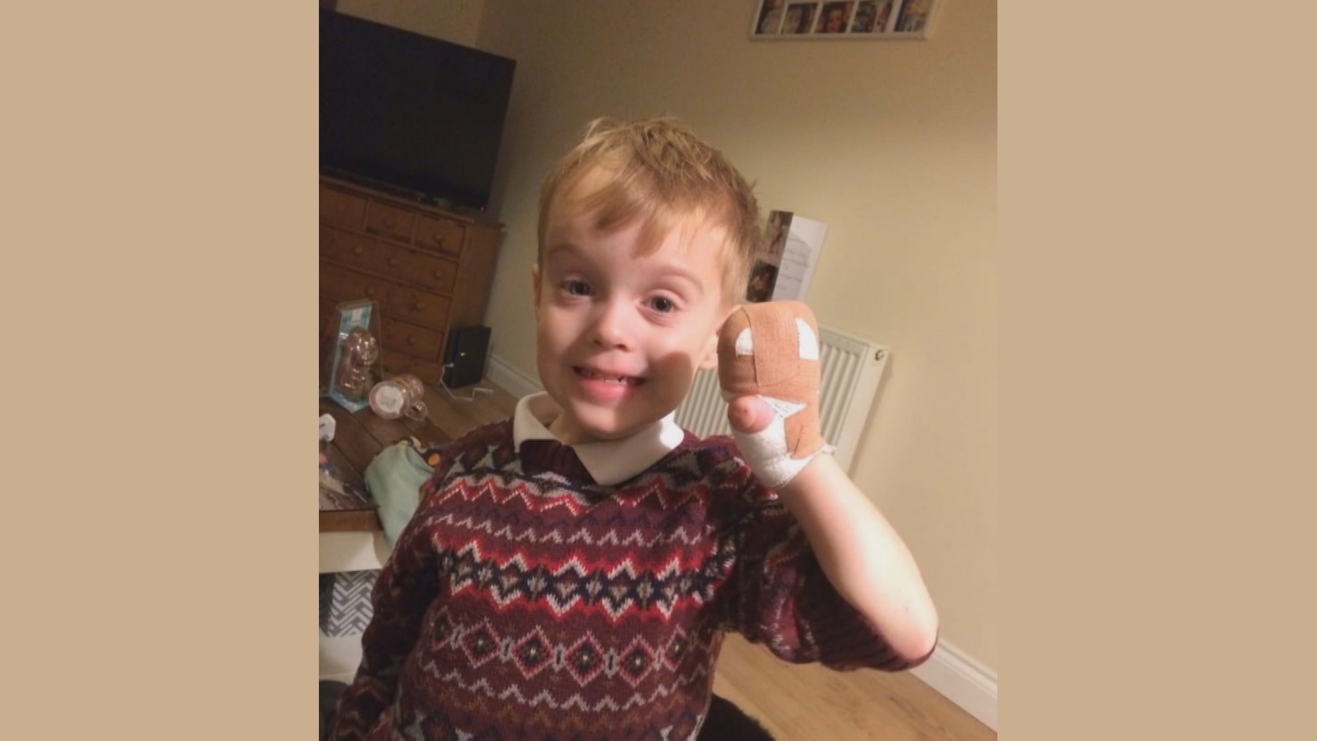 Kent boy able to climb thanks to prosthetic hook