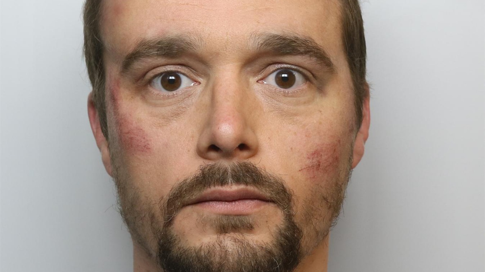 Man Jailed For Assaulting Police Officer And Ambulance Worker In ...