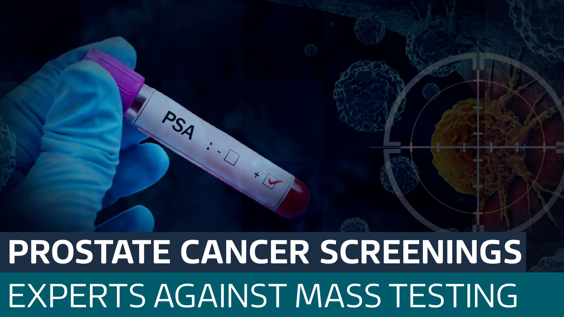 Experts advise against prostate screening for most men in UK - Latest ...