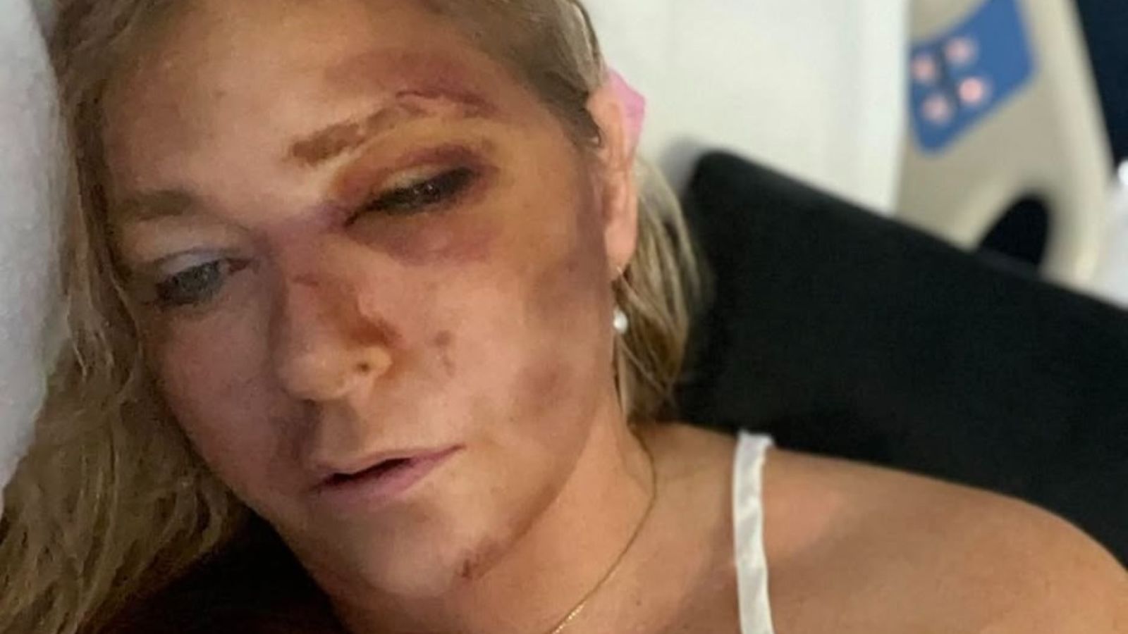 Virginia Giuffre: What is the truth after Australia crash left her with 'days to live'? | ITV News