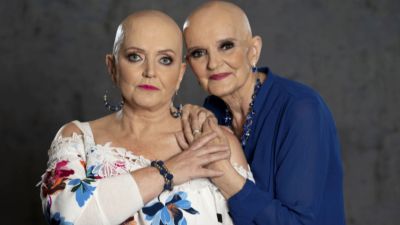 Linda and Anne Nolan after losing their hair during cancer treatment.