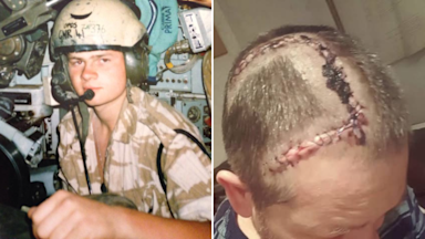 More evidence rare mutation in veterans' brains linked to blast exposure
