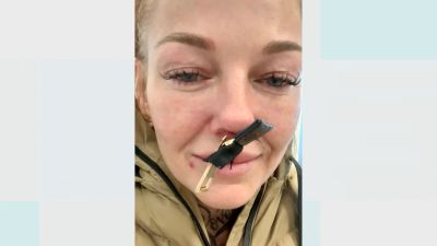 Gateshead beauty salon owner seeks medical help after getting handbag zip  stuck in nose