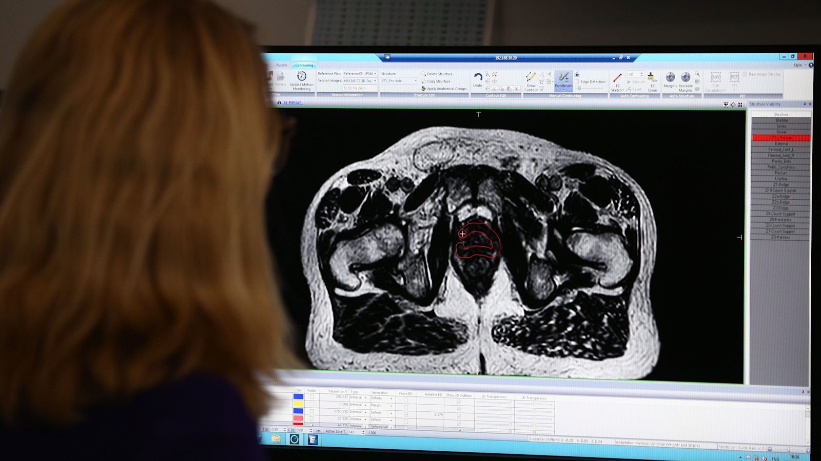 Image for Trial for prostate cancer treatment with fewer side-effects launches in UK
