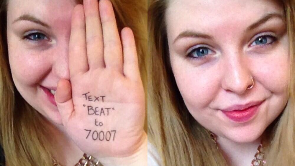 No Make Up Selfies Help Cancer Charity Raise £1m In Just 24 Hours Itv News