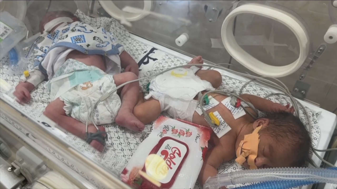 Babies are starving to death in Gaza's last children's unit, doctors say