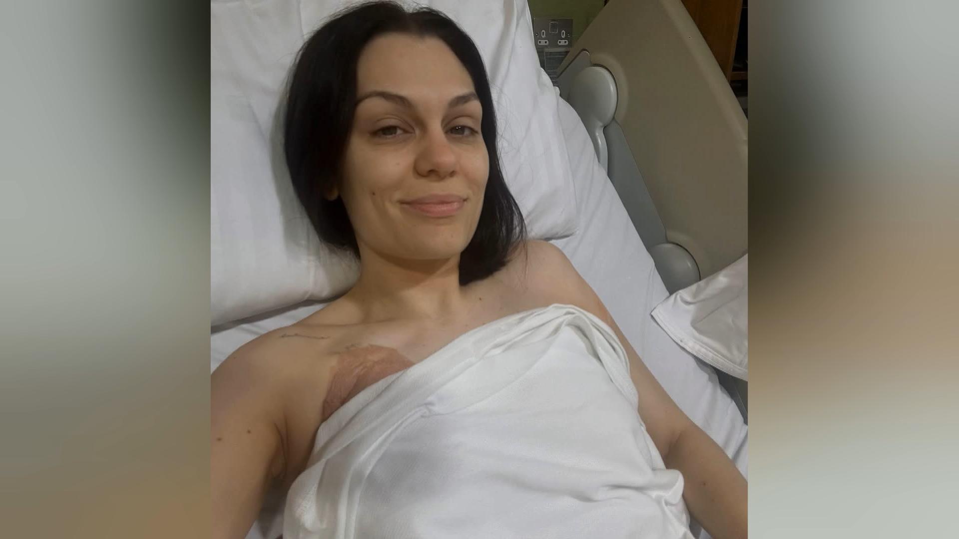 Jessie J undergoes surgery for breast cancer