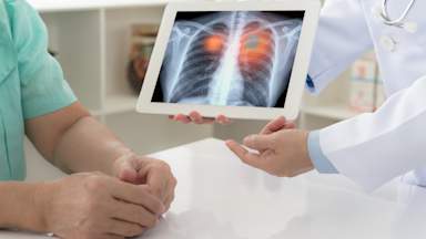 Urine test for lung cancer ‘could be ready for NHS use in five years’