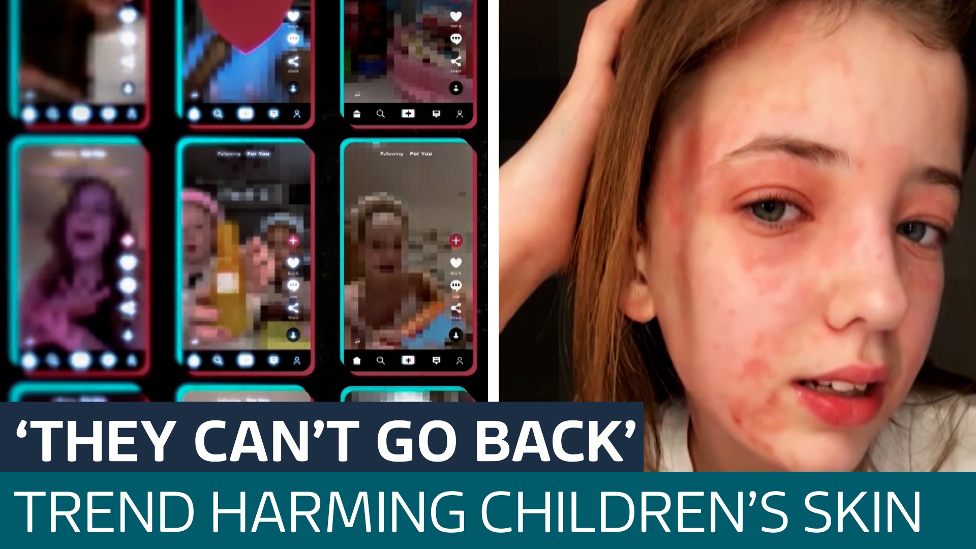 ‘Parents don't realise how damaging it is’: Meet the children using anti-ageing skincare products