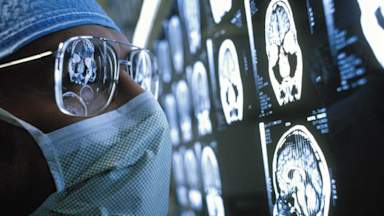Wait for brain tumour diagnoses could be cut from weeks to hours with new test