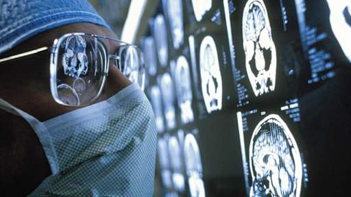 Wait for brain tumour diagnoses could be cut from weeks to hours with new test