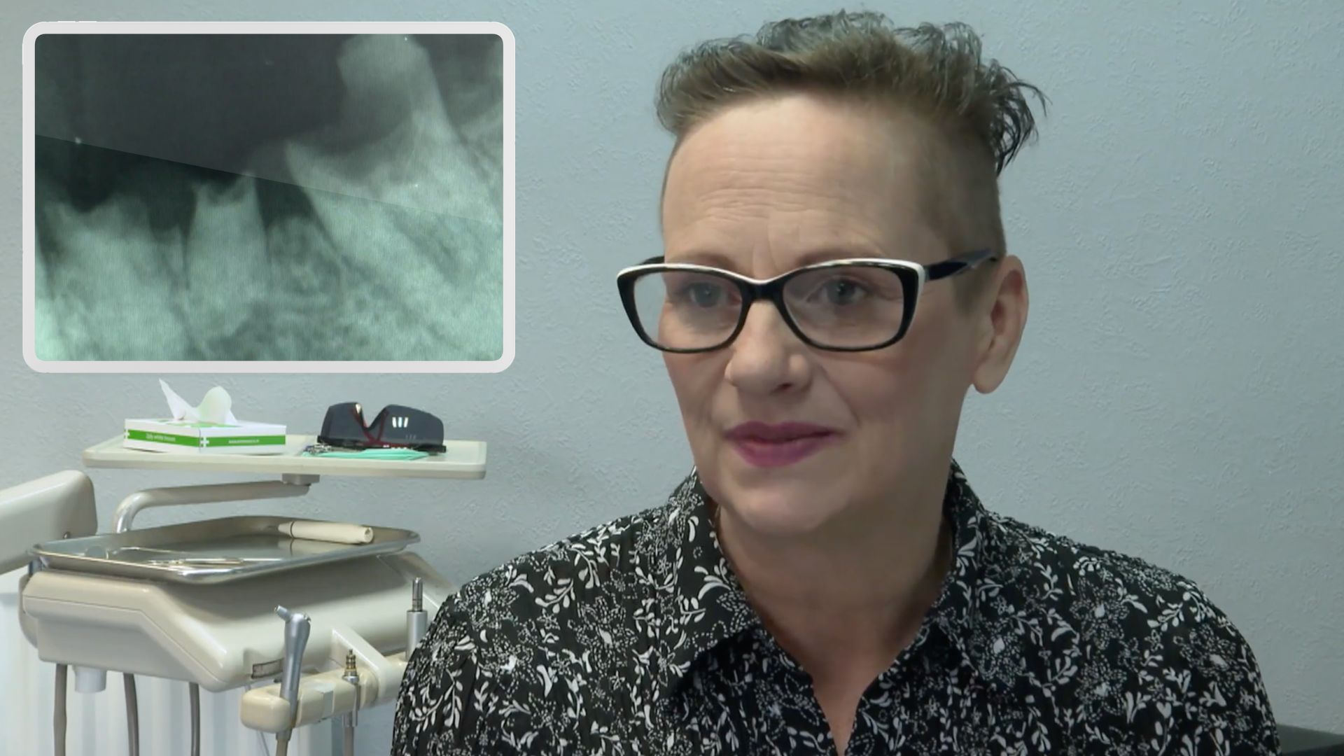 teesside-woman-left-eating-baby-food-due-to-tooth-decay-after
