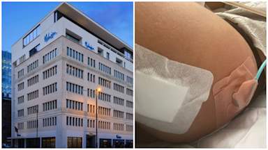 UK hotel chain bans aesthetic companies after woman has botched BBL