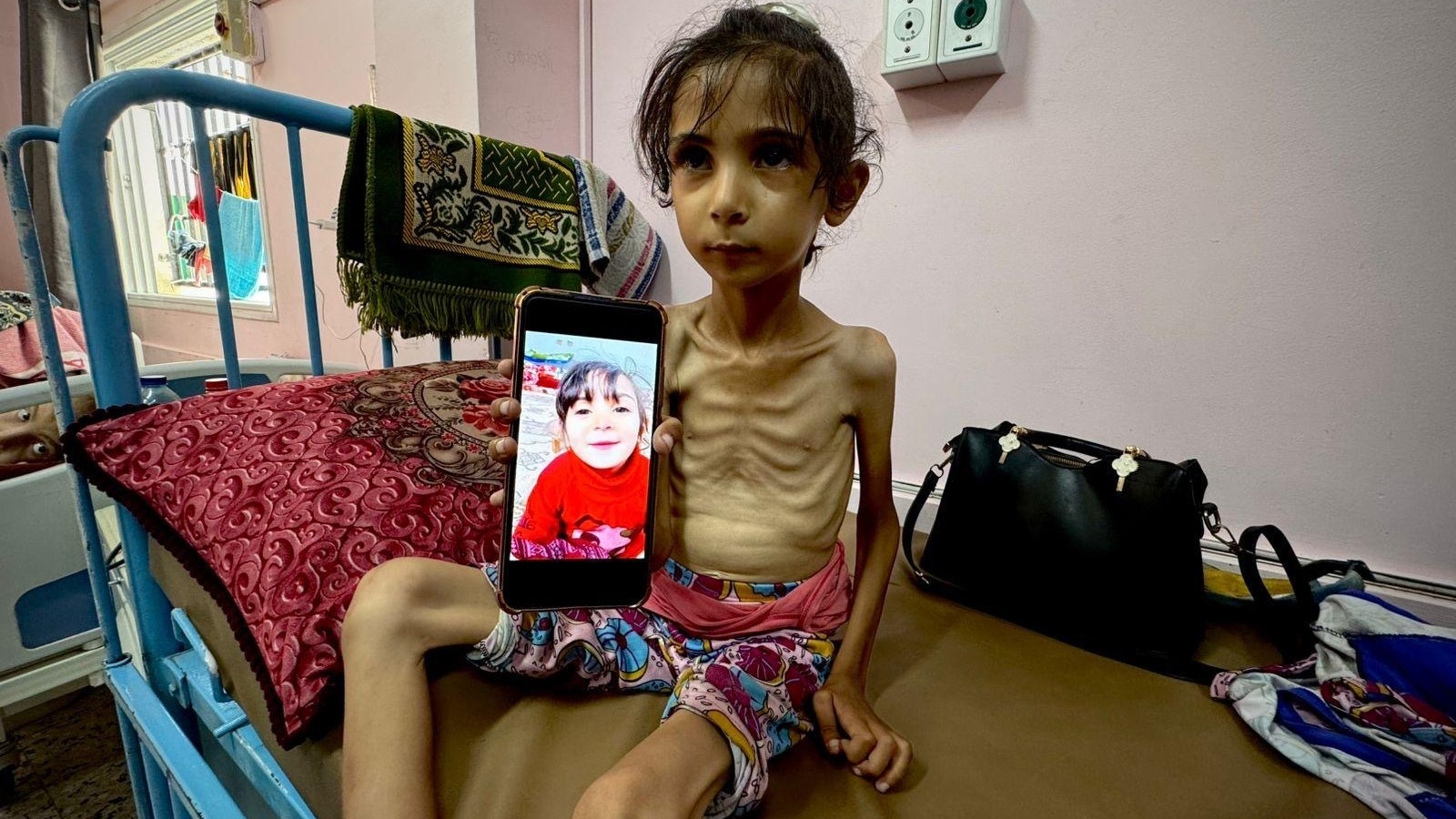'I want to look like I used to': Malnourished Amal, 7, pleads for help in Gaza