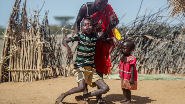 220622 A mother helps her malnourished son stand after he collapsed near their home in the village of Lomoputh in northern Kenya, AP