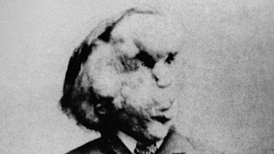 Elephant Man Joseph Merrick
