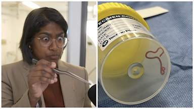 Surgeon felt 'a bit sick' after plucking worm from woman's brain