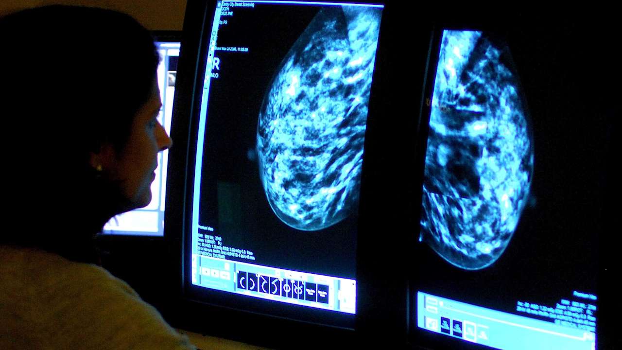New tech promised to help millions of cancer patients receive faster diagnosis