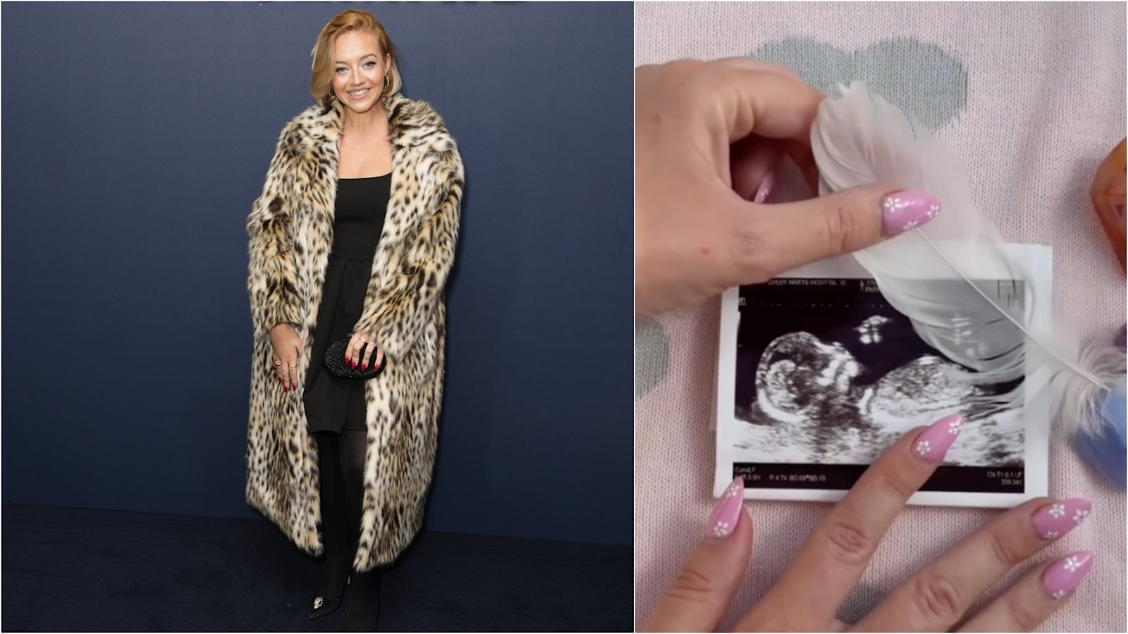 Kelsey Parker Reveals She Is Pregnant With Rainbow Baby After Stillbirth Kelsey Parker Reveals She Is Pregnant With Rainbow Baby After Stillbirth