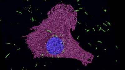 image of gold nanotubes in mesothelioma cells