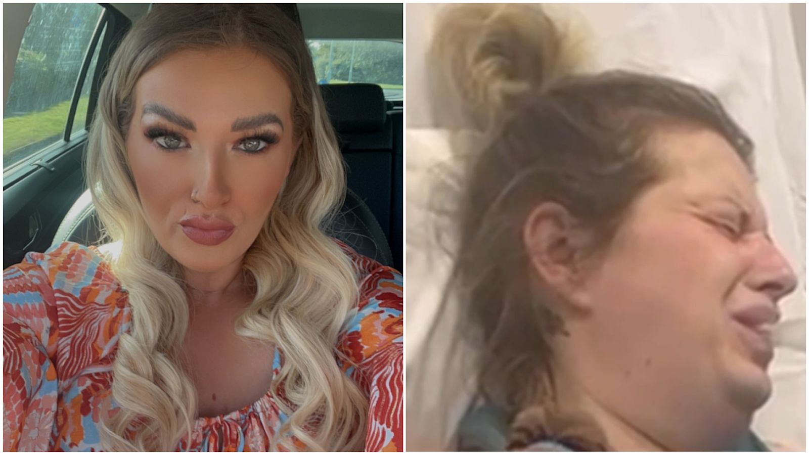 Botched Plastic Surgery