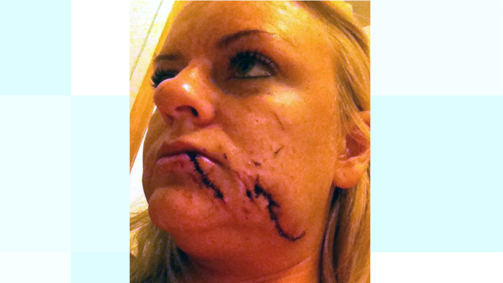 Wedding guest jailed for glass attack that left bridesmaid ...
