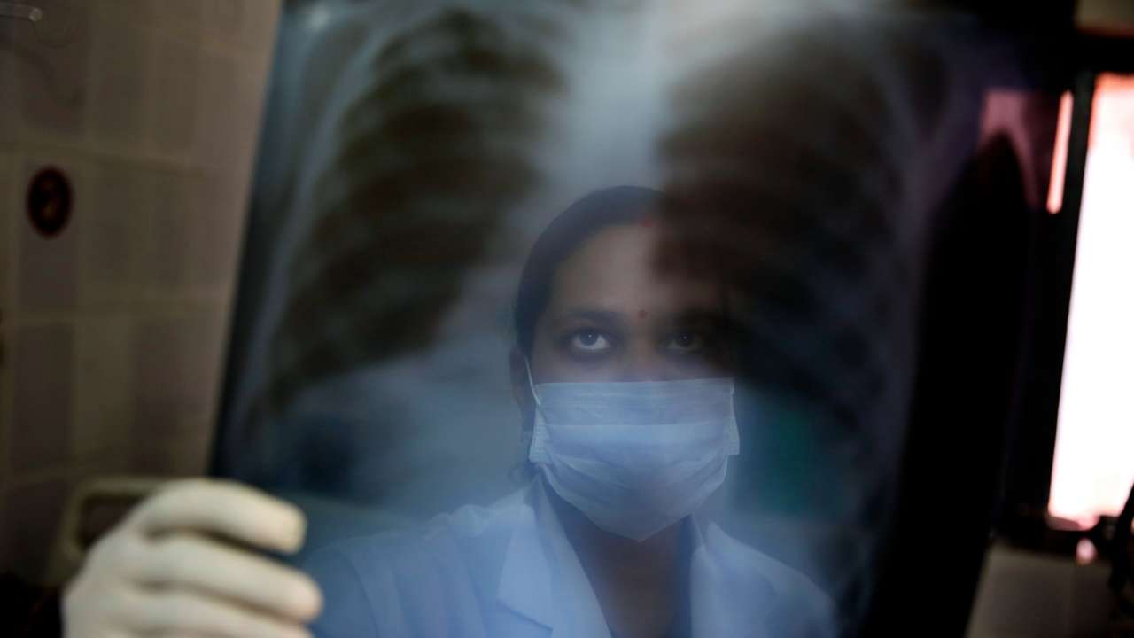 Blood test could identify millions spreading tuberculosis unknowingly