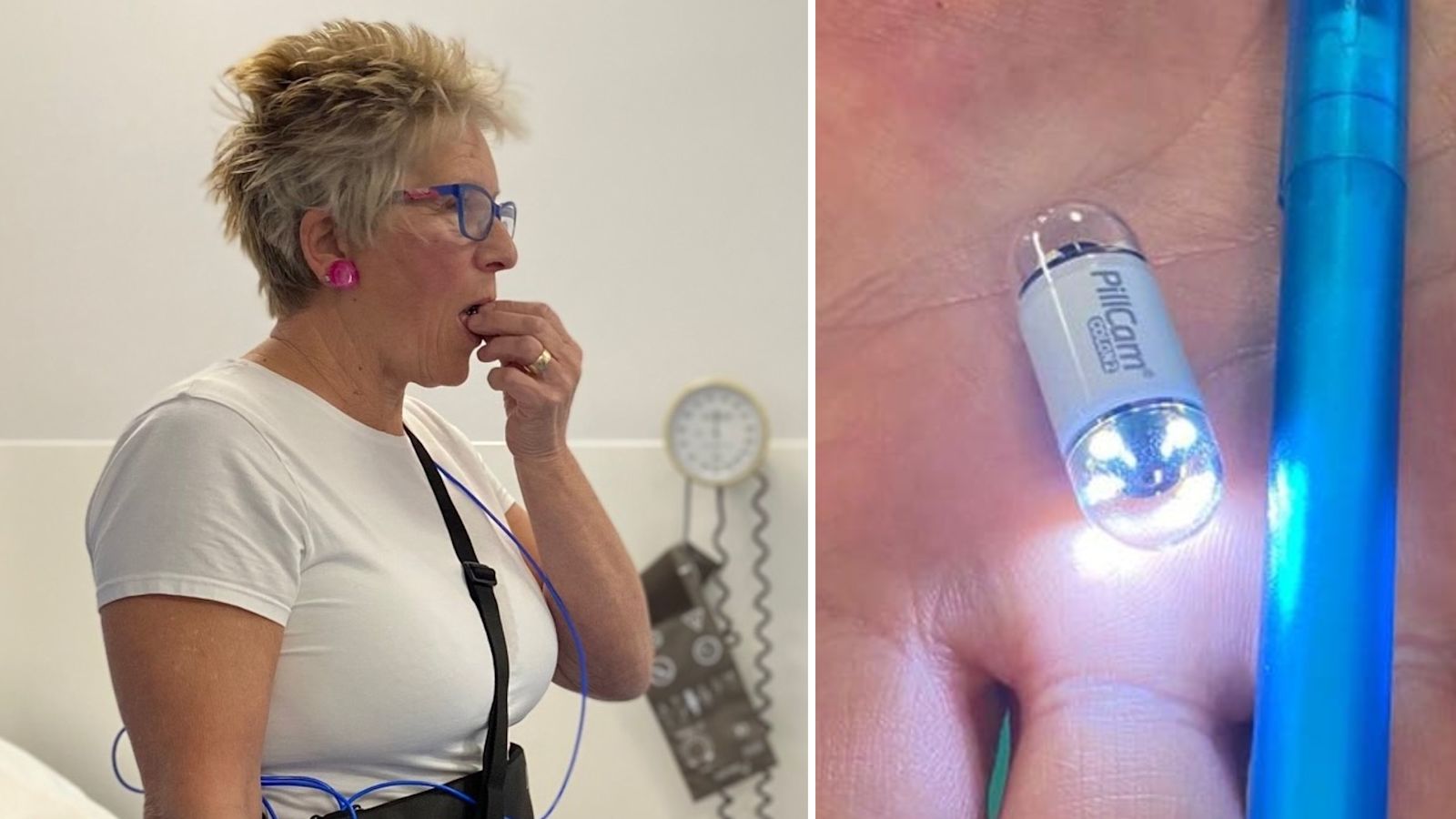 Colonoscopy Track Colonoscopy Camera Pill