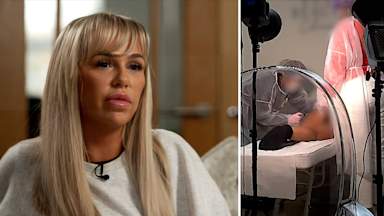 20 minutes from death: When non-surgical Brazilian Butt Lift fillers go wrong