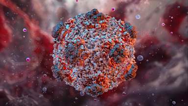 What is hantavirus, the illness suspected to have killed three on a cruise ship?