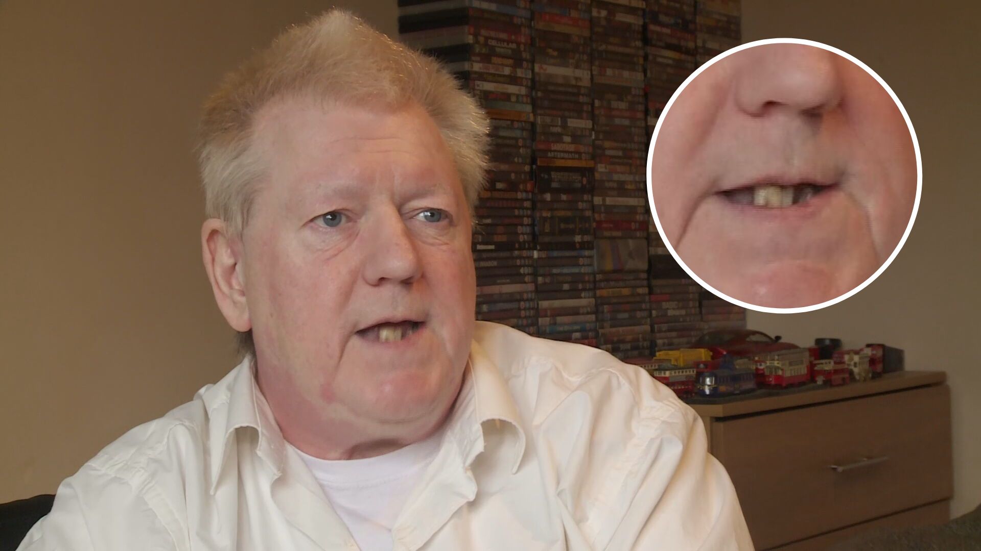 'I can't eat steak unless it's soup' Agony of Rotherham man waiting