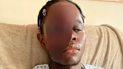 graphic injuries racist attack