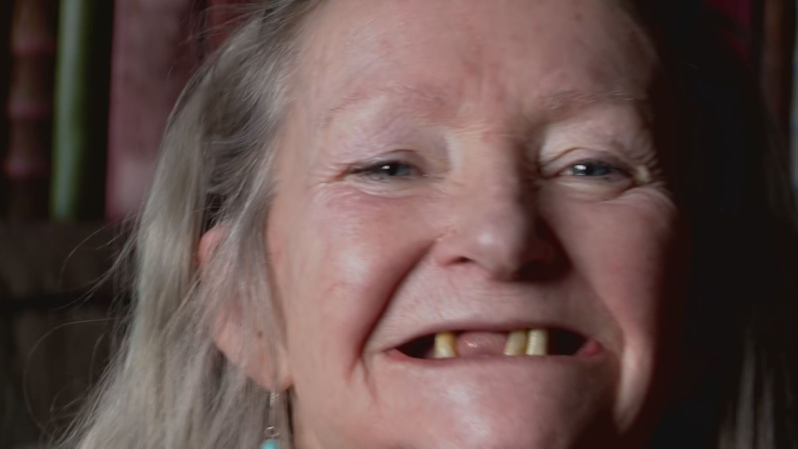 Woman who pulled out 12 teeth with pliers says government failing on ...