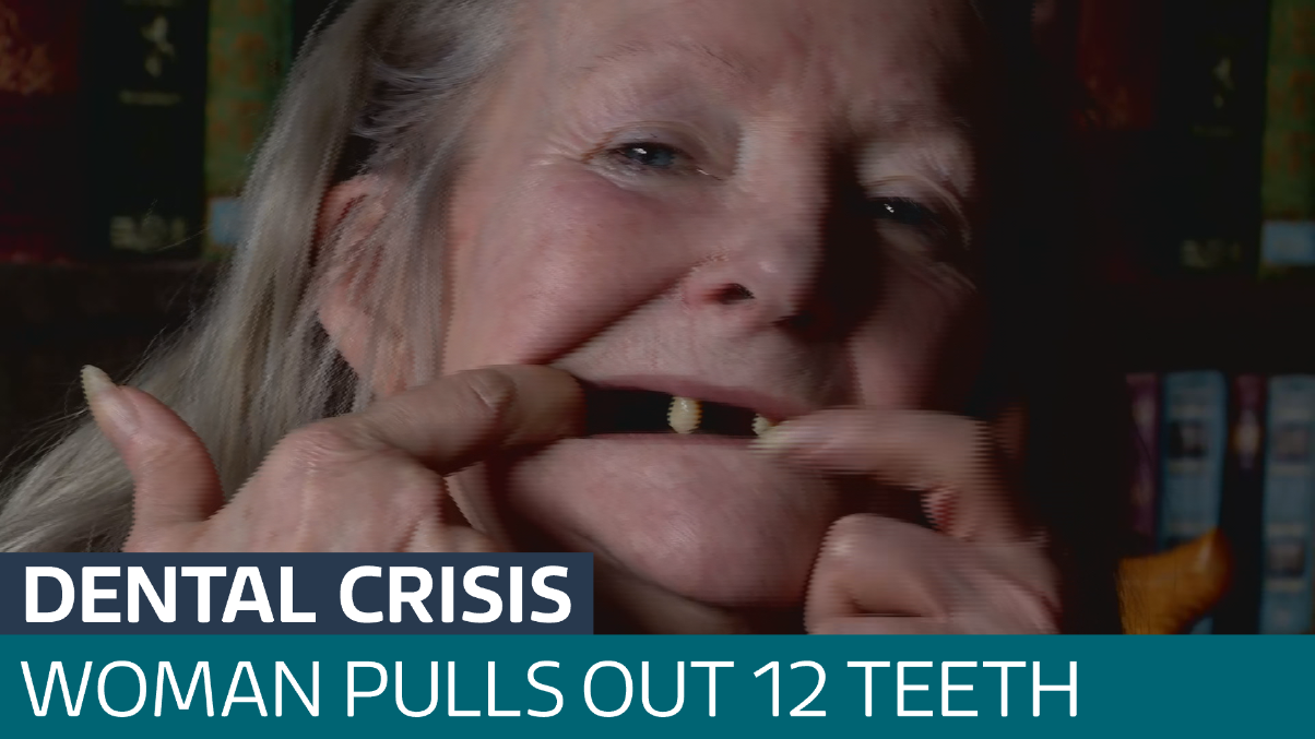 Woman pulls out 12 teeth with pliers amid dental crisis - Latest From ...