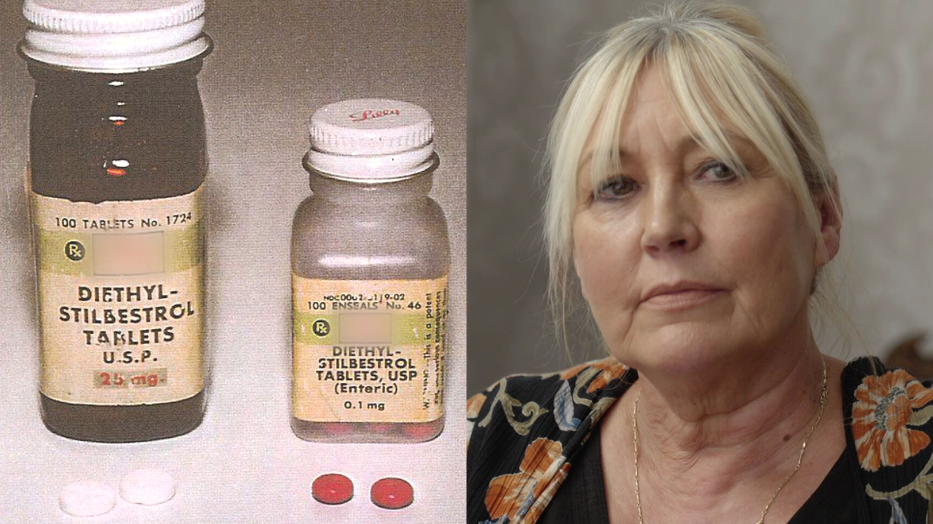Government admits state failed women given toxic pregnancy drug