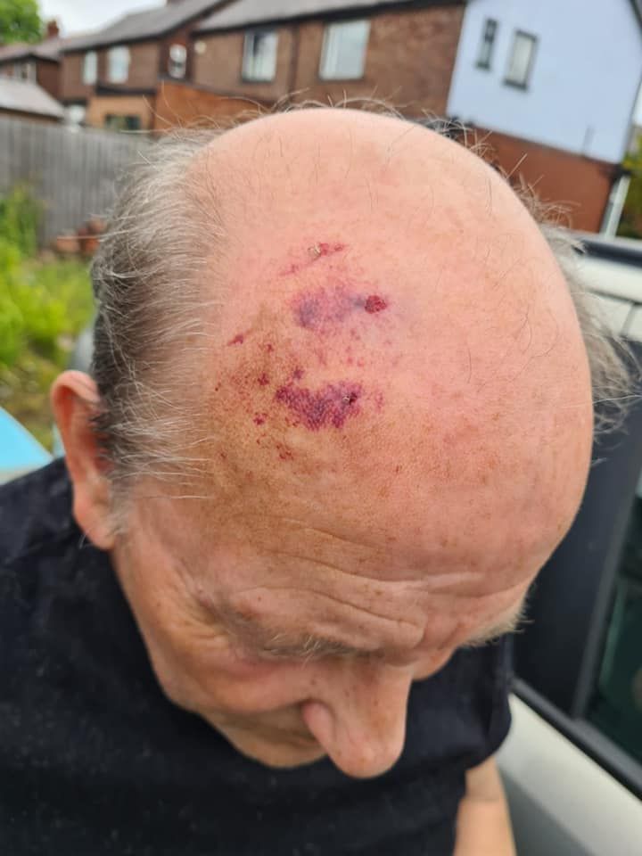 68 year old man left battered and bruised after attack at a Prestwich