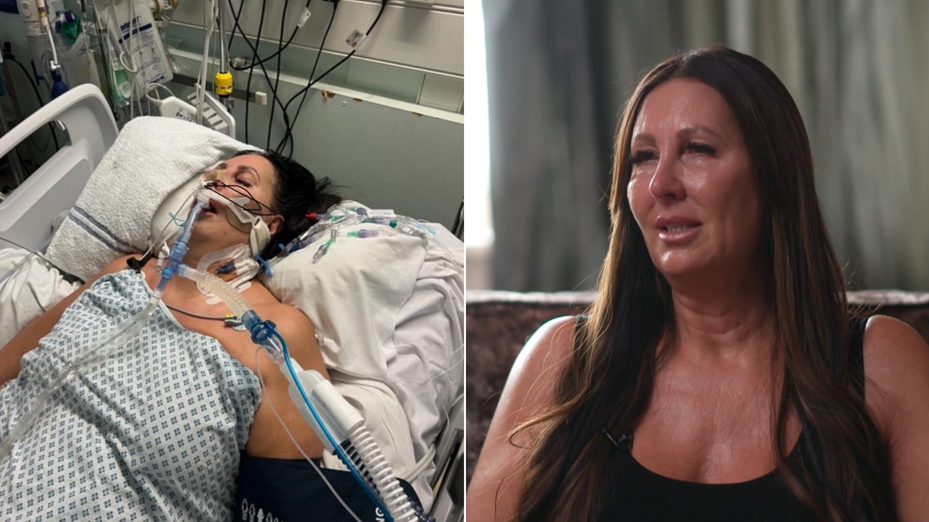 Mum falls into coma with sepsis and organ failure after botched BBL