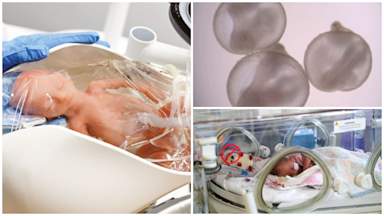 ‘Artificial wombs’: The science that could help premature babies
