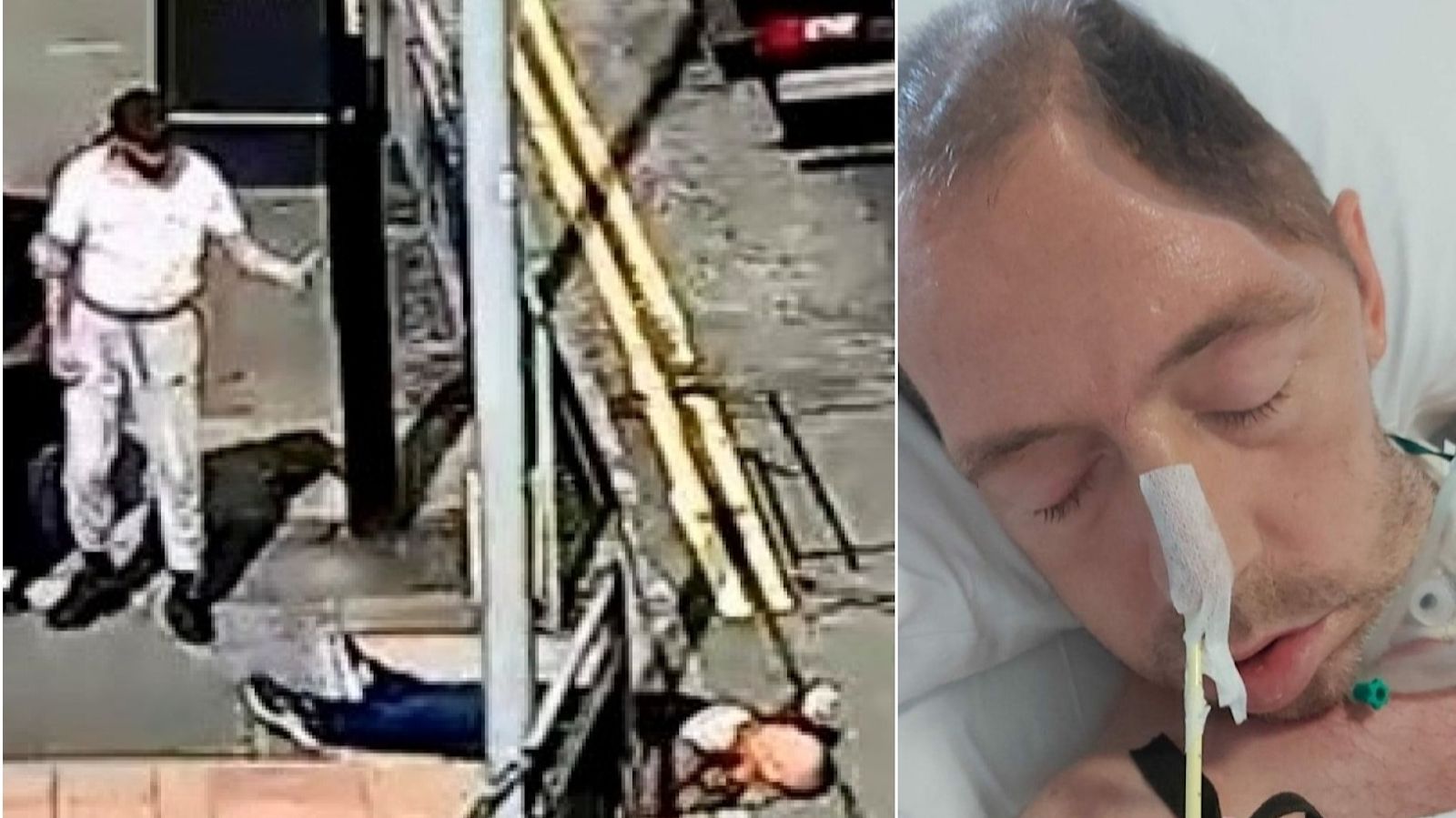 Man With Multiple Injuries Jail for man who caused victim life-changing injuries in one-punch ...