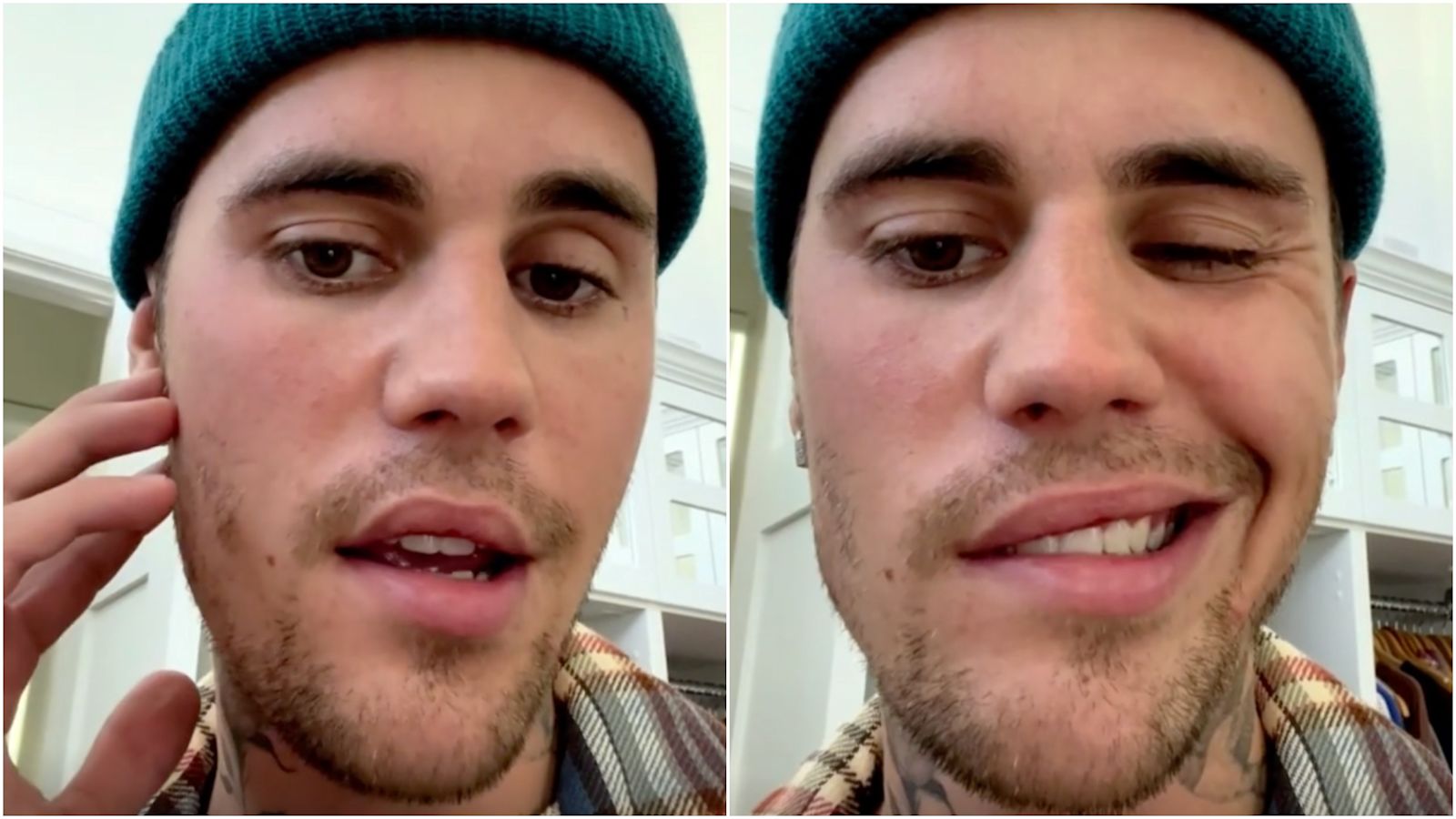 Justin Bieber Cancels Shows Due To Facial Paralysis After Ramsay Hunt justin-bieber-cancels-shows-due-to-facial-paralysis-after-ramsay-hunt