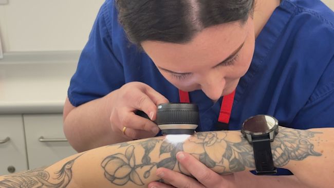 A medical professional is checking a patients skin for signs of skin cancer