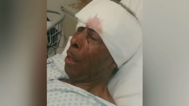 Errol Dixon was stopped in Blyth Road, Bromley, south-east London, on September 13 last year, and was said to have been left with facial fractures after his encounter with police.

