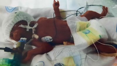 Amara Clemence born at just 25 weeks