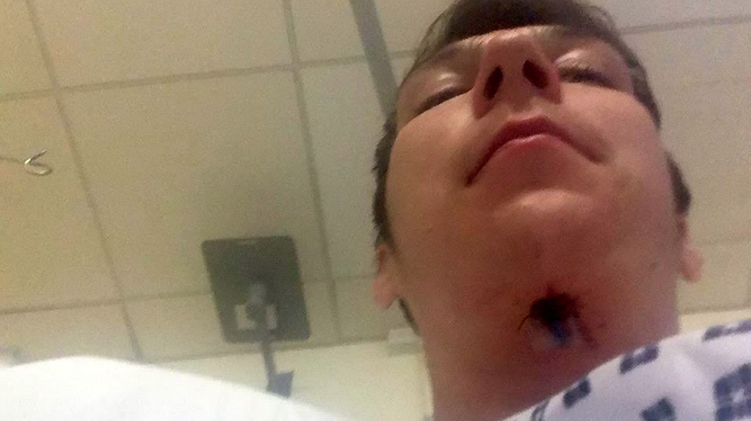 Man Nearly Died From Peroxide Poisoning After Using Diy Tooth Whitening Kit Itv News Central