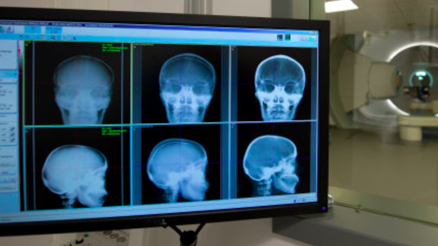 Cancer centre to get £4.8m to 'double capacity' of radiotherapy ...
